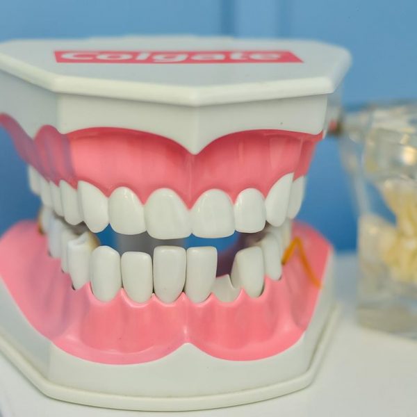 Nowoczesne implanty zębów – podstawowe informacje